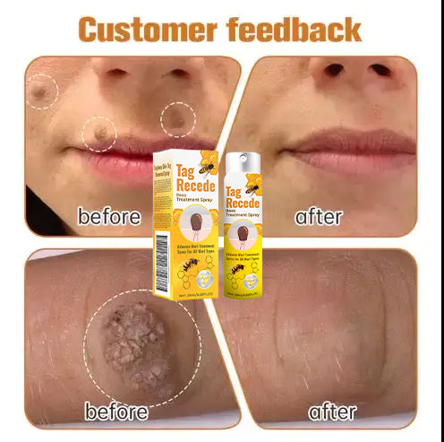 ✅Official Store: AQA™ TagRecede Bee Poison Treatment Spray