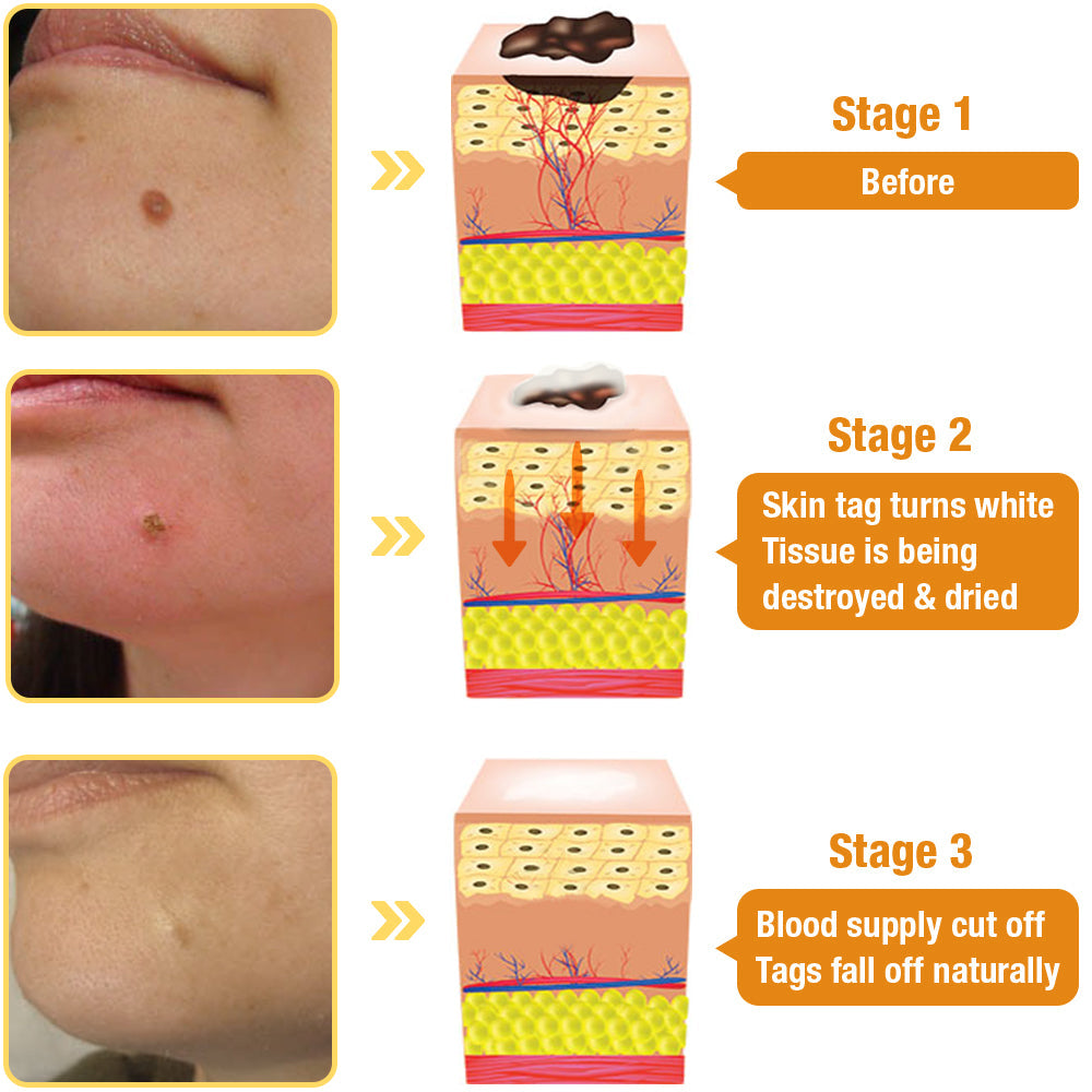 ✅Official Store: AQA™ TagRecede Bee Poison Treatment Spray