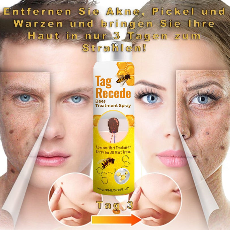 ✅Official Store: AQA™ TagRecede Bee Poison Treatment Spray